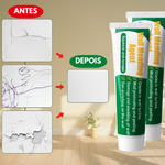 CREME PARA REPARAÇÃO DE PAREDES - WALL PASTE™