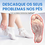 TRATAMENTO COM MEIAS ESFOLIANTES PARA PÉS COM CALOSIDADES - FeetPeel™